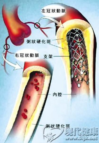 泛亚电竞平台